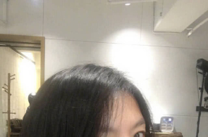 乘客乘自愿扶梯猛然摔倒 急迫闭头，她摁下“急停键”